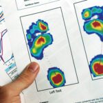 gait scan podiatry report