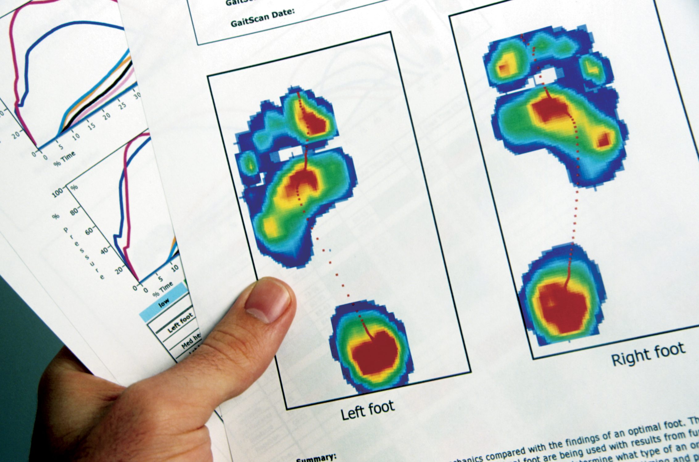 gait scan podiatry report