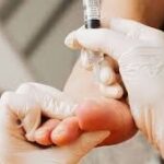 prolotherapy foot injection brisbane